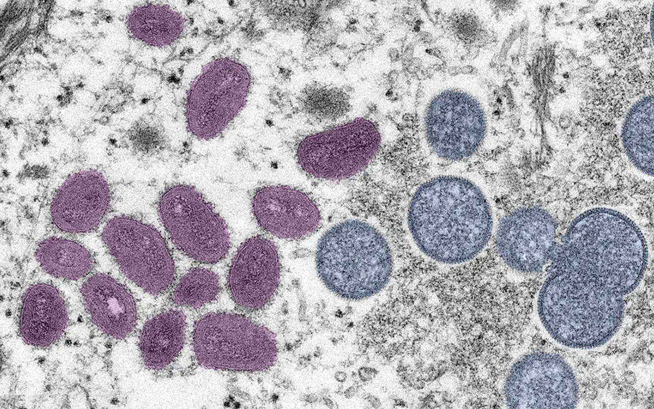 monkeypox-illustration